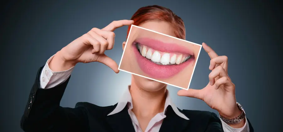 Faccette per i denti, quanto costano e come si applicano